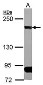 Anti-CLIP170 antibody [N1], N-term used in Western Blot (WB). GTX117504