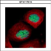 Anti-p53 (mono-methyl Lys372) antibody used in Immunocytochemistry/ Immunofluorescence (ICC/IF). GTX117515