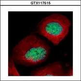 Anti-p53 (mono-methyl Lys372) antibody used in Immunocytochemistry/ Immunofluorescence (ICC/IF). GTX117515