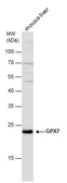 Anti-GPX7 antibody used in Western Blot (WB). GTX117516