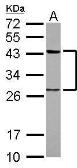 Anti-PTK9 antibody used in Western Blot (WB). GTX117546