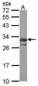Anti-PCMT1 antibody used in Western Blot (WB). GTX117559
