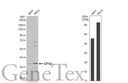 Anti-GPS2 antibody used in Western Blot (WB). GTX117560