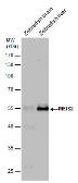 Anti-MEIS2 antibody used in Western Blot (WB). GTX117564