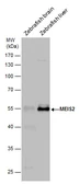 Anti-MEIS2 antibody used in Western Blot (WB). GTX117564