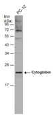 Anti-Cytoglobin antibody used in Western Blot (WB). GTX117571