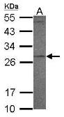 Anti-PR3 antibody [N2C3] used in Western Blot (WB). GTX117576
