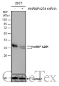 Anti-hnRNP A2B1 antibody used in Western Blot (WB). GTX117578