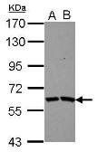 Anti-TSKS antibody [N3C3] used in Western Blot (WB). GTX117582