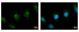 Anti-PLA2G4A antibody used in Immunocytochemistry/ Immunofluorescence (ICC/IF). GTX117583