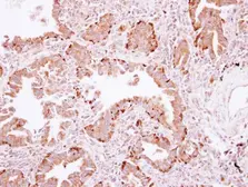 Anti-PLA2G4A antibody used in IHC (Paraffin sections) (IHC-P). GTX117583