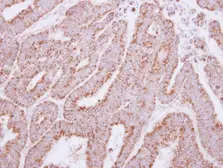 Anti-HAGH antibody used in IHC (Paraffin sections) (IHC-P). GTX117595