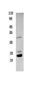 Human UBE2D2 protein, His tag. GTX117600-pro