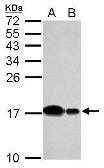 Anti-UBE2D2 antibody used in Western Blot (WB). GTX117600