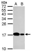 Anti-UBE2D2 antibody used in Western Blot (WB). GTX117600