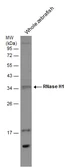 Anti-RNase H1 antibody [N2C3] used in Western Blot (WB). GTX117624