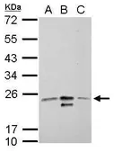 Anti-MRRF antibody used in Western Blot (WB). GTX117629