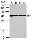 Anti-IFI35 antibody used in Western Blot (WB). GTX117640