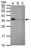Anti-IFI35 antibody used in Western Blot (WB). GTX117641