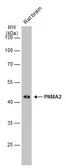 Anti-PNMA2 antibody used in Western Blot (WB). GTX117650