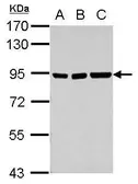 Anti-ZNF31 antibody [N3C1], Internal used in Western Blot (WB). GTX117653