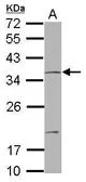 Anti-NOTCH2NL antibody [N2C3] used in Western Blot (WB). GTX117659
