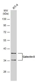 Anti-Galectin 8 antibody used in Western Blot (WB). GTX117687