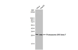 Anti-Proteasome 20S beta 7 antibody [N2C3] used in Western Blot (WB). GTX117690