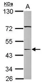 Anti-SERPINA12 antibody [N1C1] used in Western Blot (WB). GTX117696