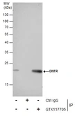 Anti-DHFR antibody used in Immunoprecipitation (IP). GTX117705