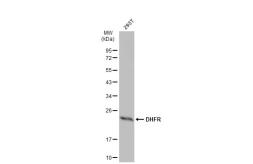 Anti-DHFR antibody used in Western Blot (WB). GTX117705