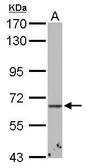 Anti-ABCE1 antibody used in Western Blot (WB). GTX117706