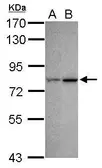 Anti-CDYL antibody used in Western Blot (WB). GTX117708