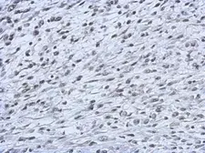 Anti-CBX2 antibody used in IHC (Paraffin sections) (IHC-P). GTX117711