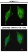 Anti-CRIP2 antibody [N1C3-2] used in Immunocytochemistry/ Immunofluorescence (ICC/IF). GTX117712