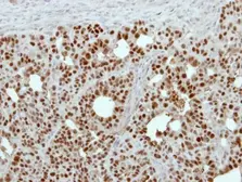 Anti-GPKOW antibody [N2C3] used in IHC (Paraffin sections) (IHC-P). GTX117717