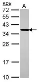 Anti-UBC3B antibody used in Western Blot (WB). GTX117722