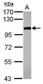 Anti-CPSF2 antibody [C1C3] used in Western Blot (WB). GTX117729