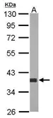 Anti-AKR1D1 antibody [N3C3] used in Western Blot (WB). GTX117738