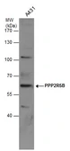 Anti-PPP2R5B antibody used in Western Blot (WB). GTX117756