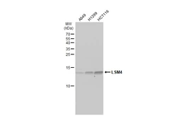 Anti-LSM4 antibody [N1C3] used in Western Blot (WB). GTX117766