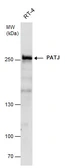 Anti-PATJ antibody [N1N2], N-term used in Western Blot (WB). GTX117767