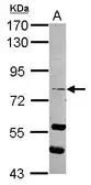 Anti-RASEF antibody [C2C3], C-term used in Western Blot (WB). GTX117780