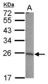 Anti-LIN7B antibody [N1C3] used in Western Blot (WB). GTX117787