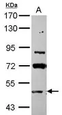 Anti-ASB3 antibody [N1N3] used in Western Blot (WB). GTX117801