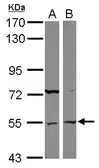 Anti-ASB3 antibody [N3C3] used in Western Blot (WB). GTX117802