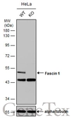 Anti-Fascin 1 antibody used in Western Blot (WB). GTX117805