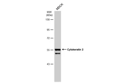 Anti-Cytokeratin 2 antibody used in Western Blot (WB). GTX117806