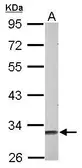 Anti-Musashi 2 antibody [N1C1] used in Western Blot (WB). GTX117808