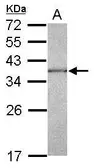 Anti-CAPZA1 antibody [N1C3] used in Western Blot (WB). GTX117813